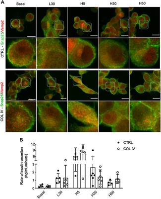 Collagen IV-β1-Integrin Influences INS-1 Cell Insulin Secretion via Enhanced SNARE Protein Expression